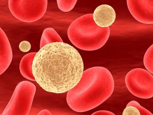 Hyperlipidemia: Causes, Symptoms and Treatment