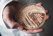 Candida Auris Infection: Symptoms and Prevention fungus-candida-auris