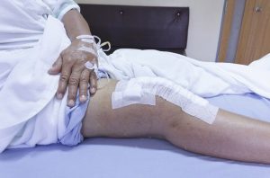 knee-replacement-surgery