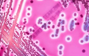 necrotizing-fasciitis-flesh-eating-disease