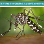Beware! West Nile Virus: Symptoms, Causes, and Prevention West Nile Virus_mosquito_bite_skin