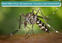 Beware! West Nile Virus: Symptoms, Causes, and Prevention West Nile Virus_mosquito_bite_skin