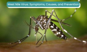 West Nile Virus_mosquito_bite_skin West Nile Virus_mosquito_bite_skin